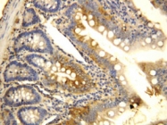 PAB12270 - CD196 / CCR6