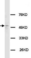 PAB12272 - Histamine H3 receptor
