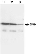 PAB12277 - CD120a / TNFR1