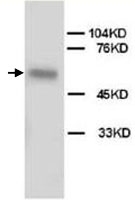 PAB12279 - Alkaline phosphatase / ALPL