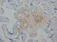 PAB12280 - Angiopoietin-2
