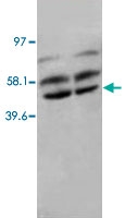 PAB12283 - PPP2CA