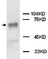 PAB12287 - PTPN11 / PTP2C