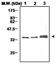 PAB1229 - Cyclin D1