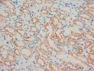 PAB12293 - MMP-16