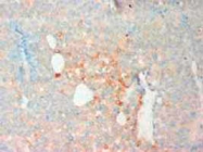 PAB12294 - CD18 / ITGB2