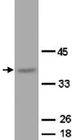 PAB12300 - OPCML / OBCAM