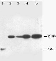 PAB12305 - NOTCH1