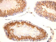 PAB12306 - FGF8