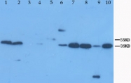 PAB12307 - XAF1