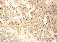 PAB12307 - XAF1
