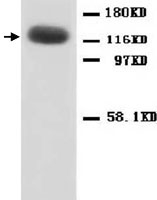 PAB12310 - NMDA Receptor 1