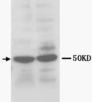 PAB12311 - Heparanase / HPSE