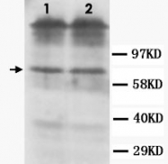 PAB12318 - Dopamine D1 receptor