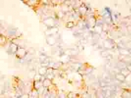 PAB12319 - Bcl-2-like 1
