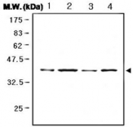 PAB1232 - MAP kinase p38 alpha / MAPK14