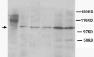 PAB12320 - Cullin-4B