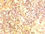 PAB12320 - Cullin-4B