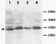 PAB12322 - SSX2