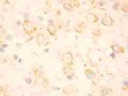 PAB12325 - GFAP