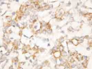 PAB12326 - Cytokeratin 8