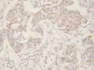 PAB12326 - Cytokeratin 8