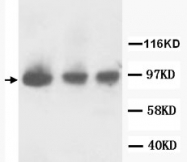 PAB12327 - CD332 / FGFR-2