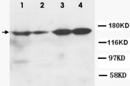 PAB12328 - ROCK2