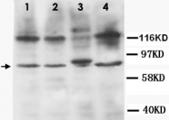 PAB12329 - CD120b / TNFR2
