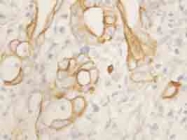 PAB12329 - CD120b / TNFR2