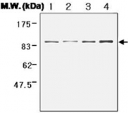 PAB1233 - Catenin beta-1