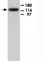 PAB12333 - HIF2A / HIF2 alpha