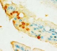 PAB12333 - HIF2A / HIF2 alpha
