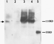 PAB12335 - NTE