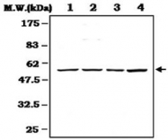 PAB1235 - Cyclin E1