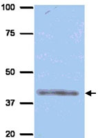 PAB12360 - Aurora kinase B