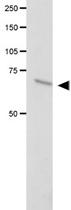 PAB12372 - FANCC