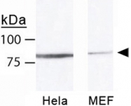 PAB12381 - MRE11