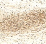 PAB12382 - MMP-2