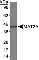 PAB12387 - MAT2A