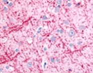 PAB12390 - LC3B