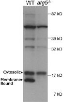 PAB12390 - LC3B
