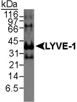 PAB12392 - LYVE-1