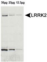 PAB12393 - PARK8 / LRRK2