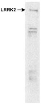PAB12394 - PARK8 / LRRK2