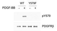 PAB1240 - CD140b / PDGFRB