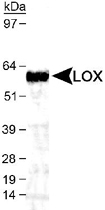 PAB12403 - Lysyl oxidase