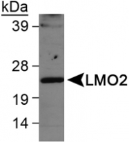 PAB12404 - Rhombotin-2