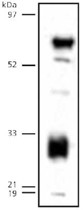 PAB12405 - LIPG