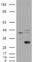 PAB12405 - LIPG